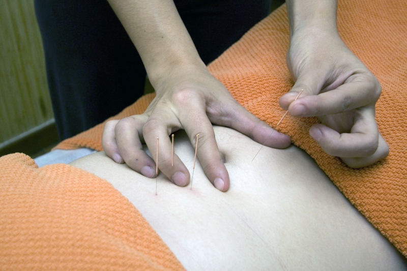 osteopathe-STE MAXIME-min_acupuncture-4175625